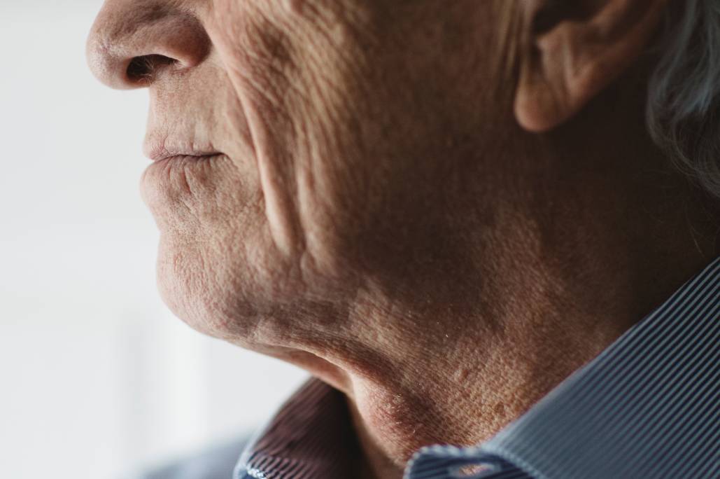 Alzheimer’s Disease mobile